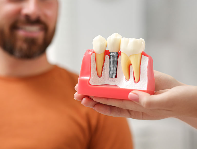Transform Your Smile and Protect Your Teeth with Crossroad Dental in Irvine