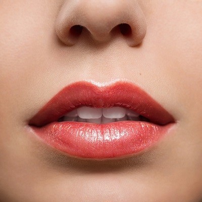 Lip Filler Trends in Islamabad – What’s Popular in 2025?
