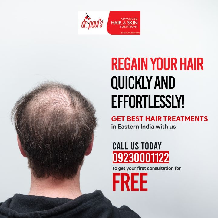 Understanding Hair Transplant in Kolkata: Procedure, Benefits & Cost