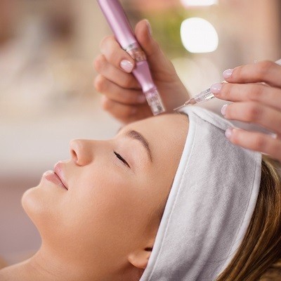 Microneedling vs. Laser Treatments: Which One is Better?