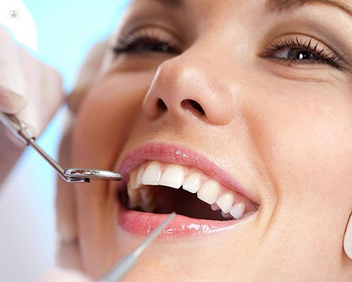 Regain Confidence and Functionality with Permanent Dentures in Tampa