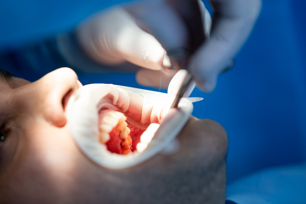 Exploring the Types of Dental Crowns and Their Unique Benefits