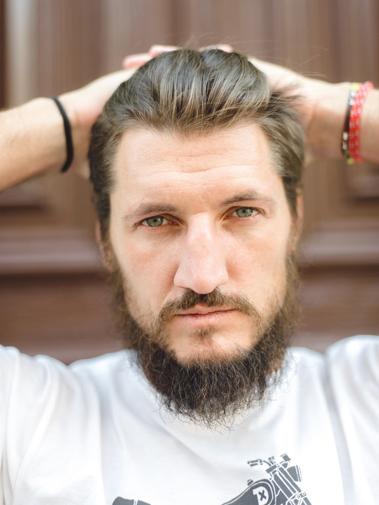 How Long Does a Beard Hair Transplant Take to Heal?