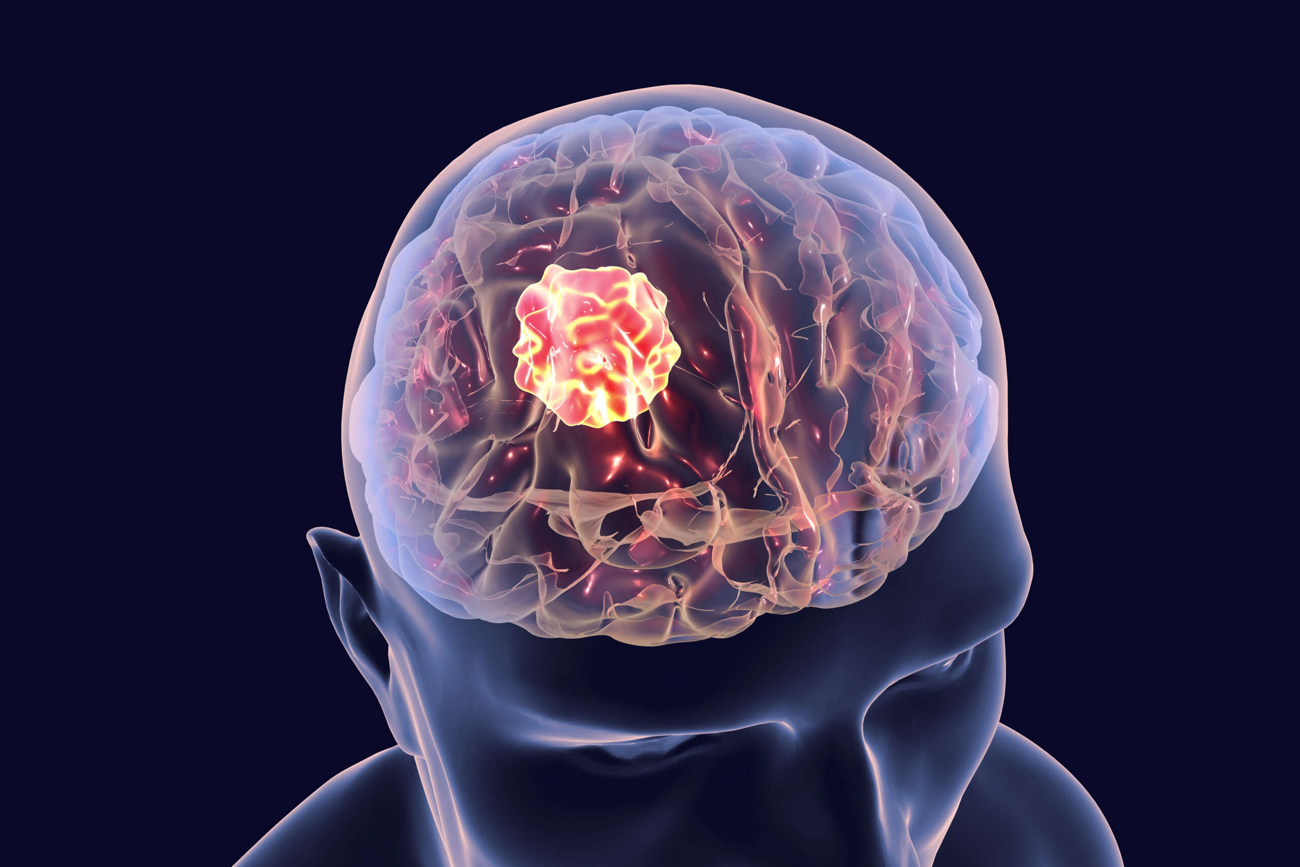 Hitachi, Ltd.: Pioneering Innovations in the Brain Tumor Diagnosis & Therapeutics Market