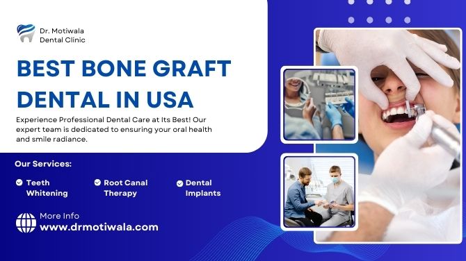 Best Bone Graft Dental in USA