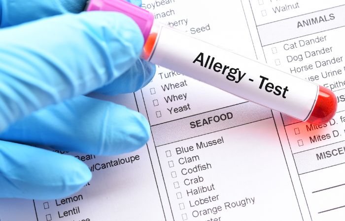 Food Allergy Testing: How It Can Help You Manage Your Symptoms