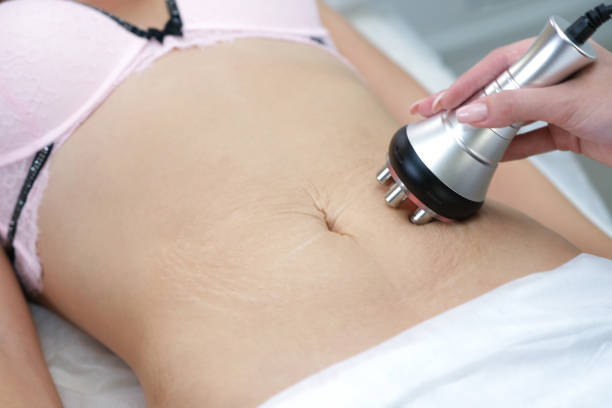 The Future of Body Contouring: Vaser Liposuction in Riyadh