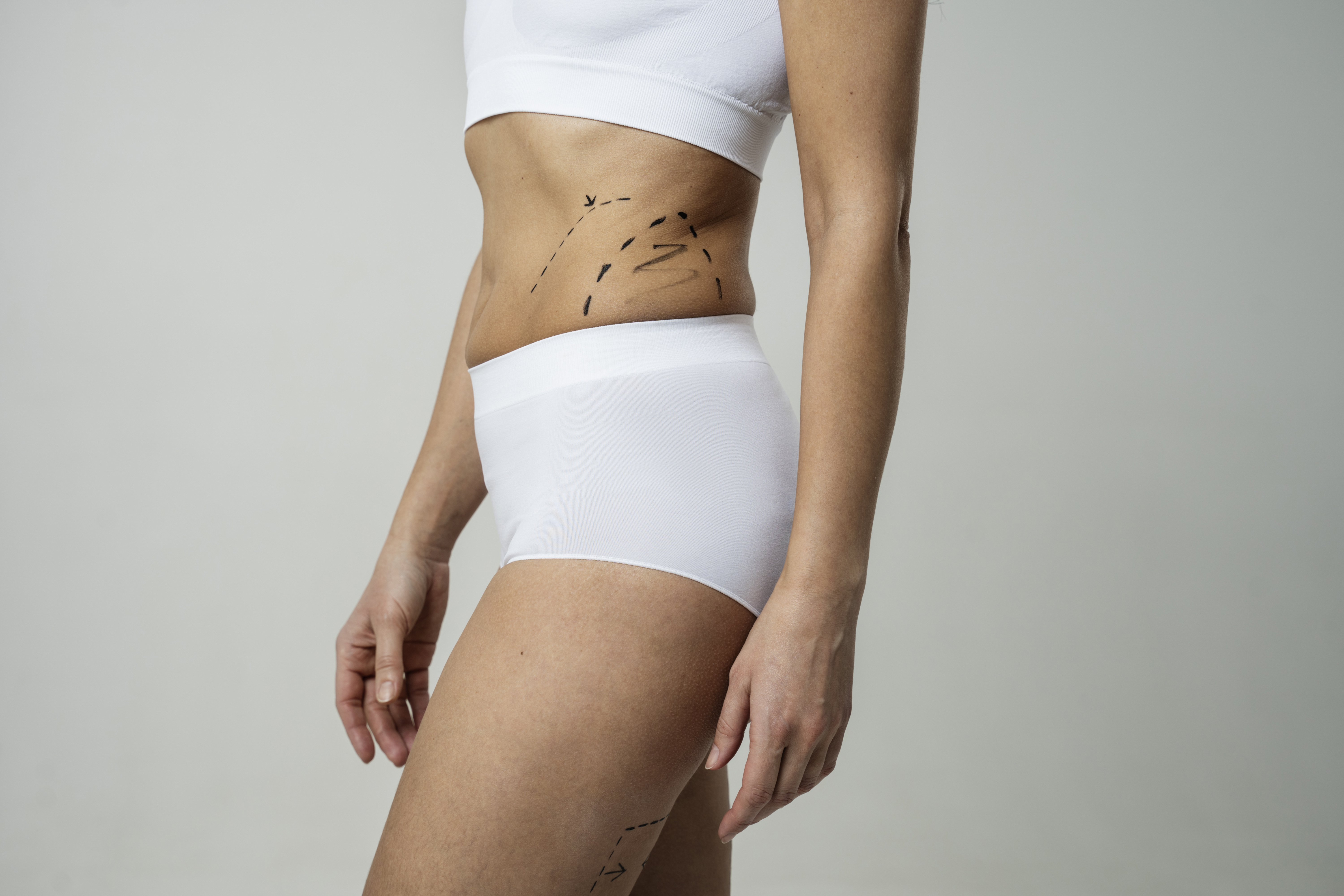 Say Goodbye to Scars: Best Scar Removal Services in Phoenix