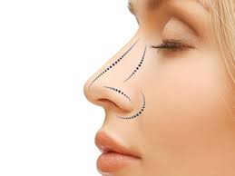 Rhinoplasty in Riyadh: Enhance Your Beauty with Precision