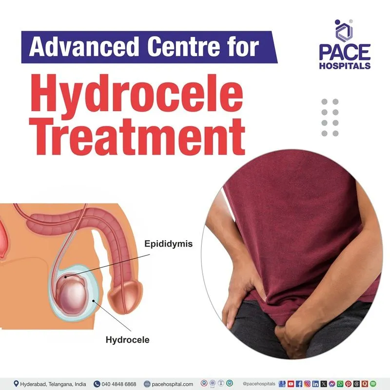 Best Hydrocele Treatment Hospital in Hyderabad, India