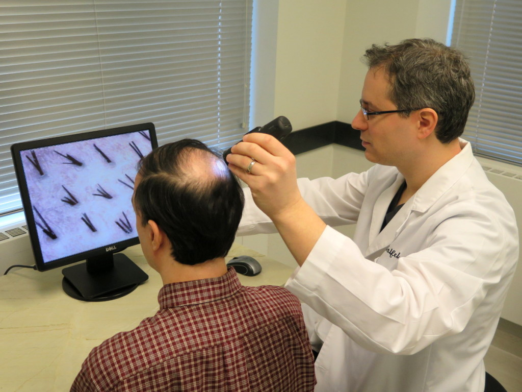 How to Manage Alopecia with a Hair Doctor