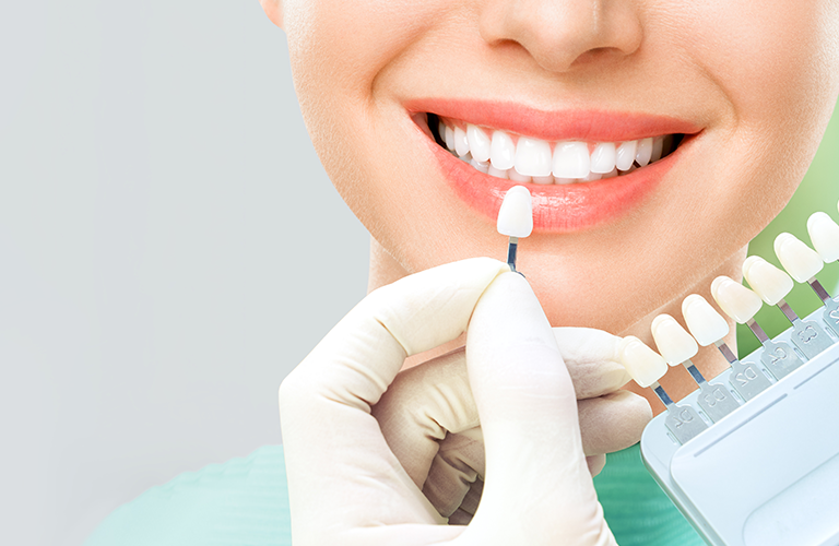How to Choose the Right Cosmetic Dentist for Your Needs
