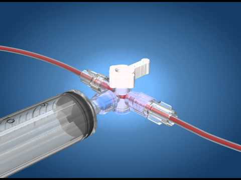 Consumer Demand: Understanding the Adoption of Closed Blood Sampling Systems Market