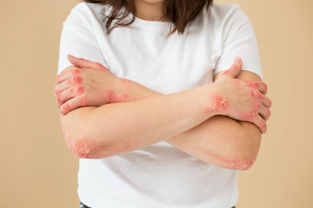 How Long Does TSW Treatment Take? Recovery Timelines and Expectations