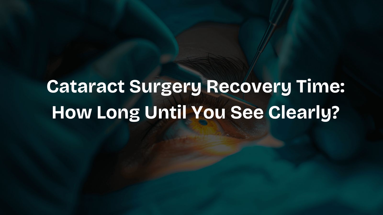 Cataract Surgery Recovery Time: How Long Until You See Clearly?