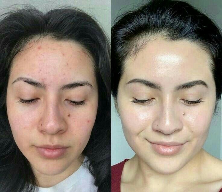 Achieve a Radiant Complexion with Advanced Skin Brightening Treatments