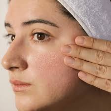 Effective Ways to Minimize Large Pores and Achieve Smooth Skin