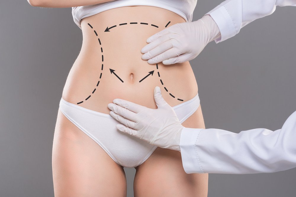 Which Anesthesia is Better for Liposuction?