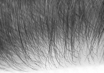 5 Reasons Thin Skin Hair Systems Are the Most Undetectable