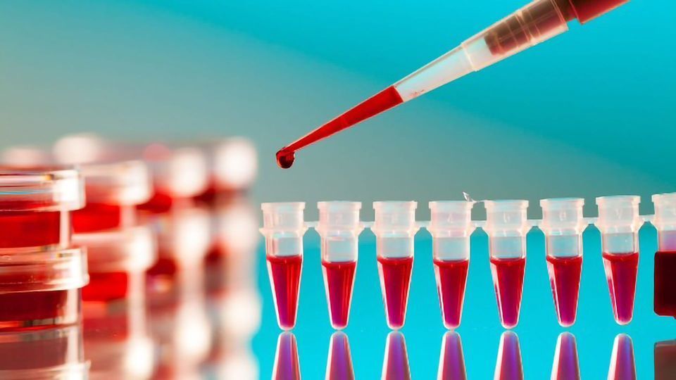 Are Blood Tests for Body Analysis Essential for Overall Wellness?