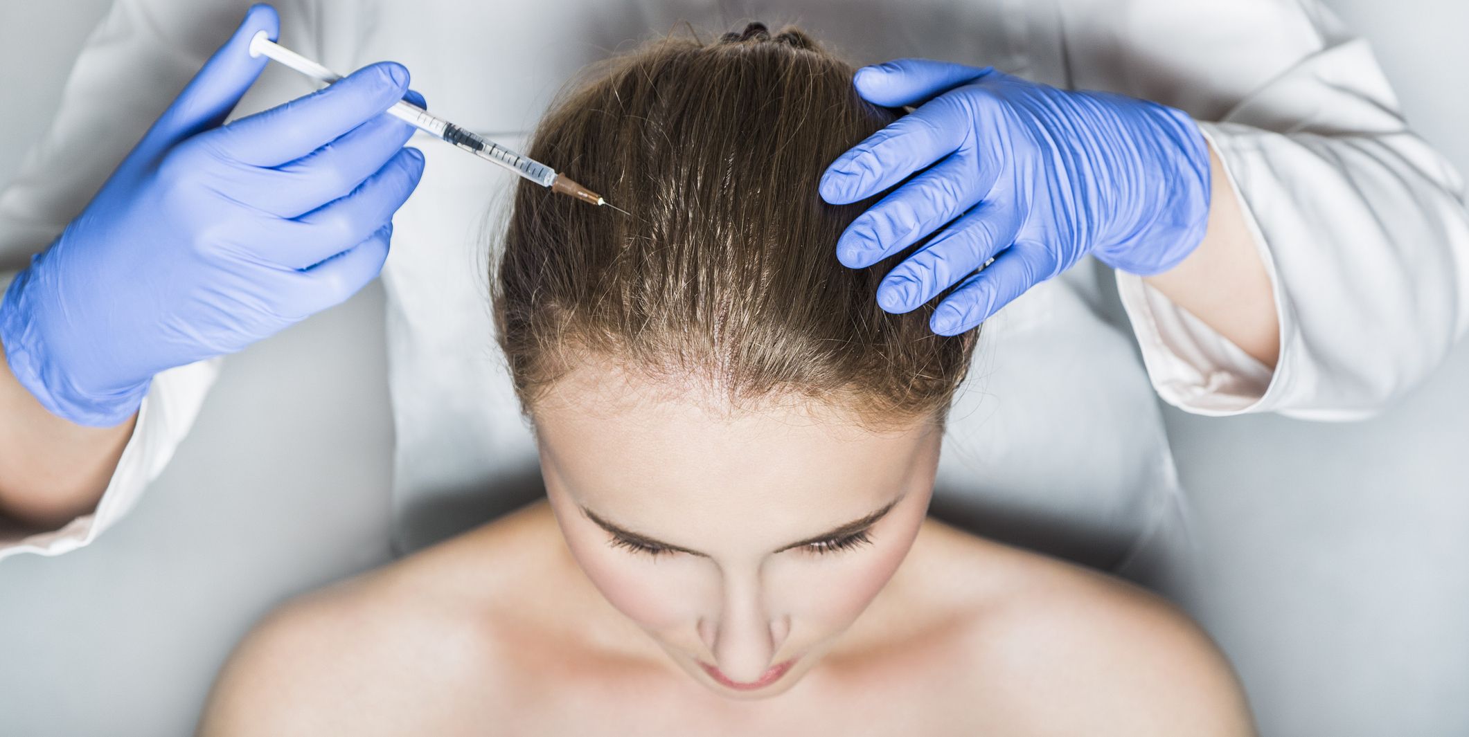 Why Hair Transplants Are Gaining Popularity in 2025