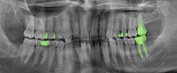 Midmark Corporation: Leading the Charge in Dental Imaging Market Innovations and Strategies