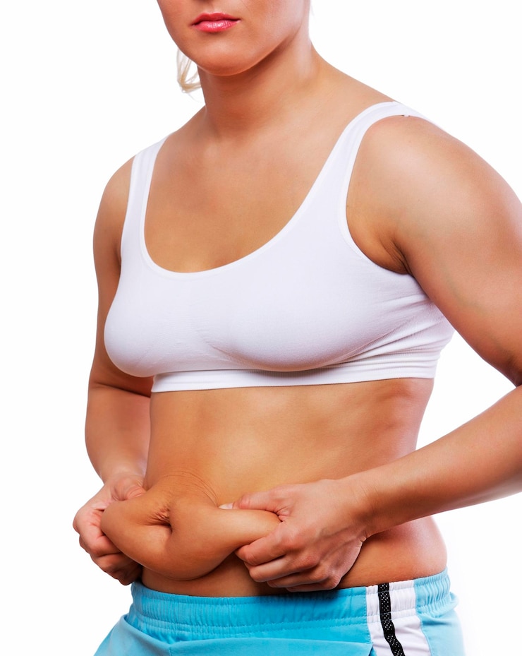 How Do Surgeons Perform a Tummy Tuck ?