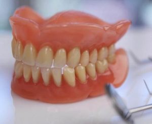 Tooth Replacement Options for Elderly Patients