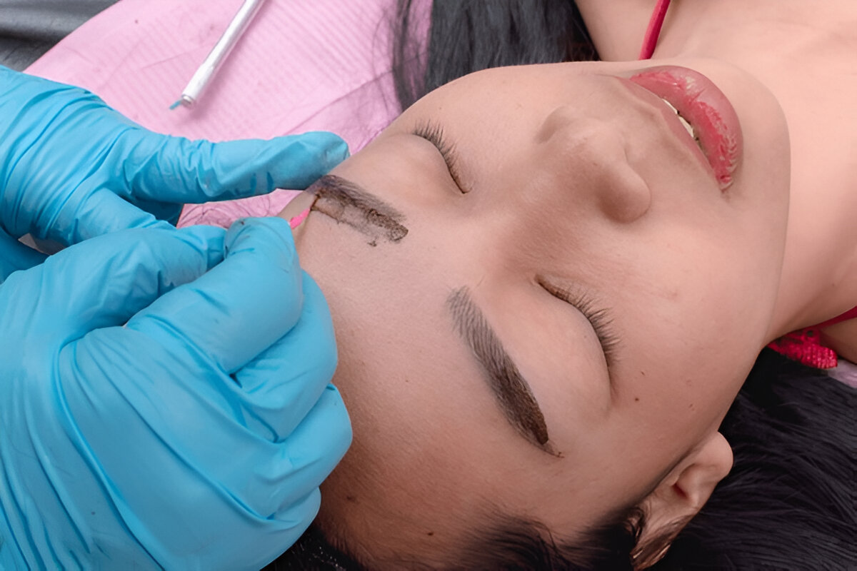 Implante de Cejas: Recupera la Armonía y Belleza de tu Mirada con DrEO Hair Clinic