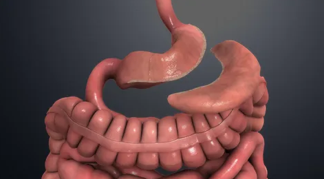 What to Eat After Endoscopic Sleeve Gastroplasty? A Complete ESG Diet Guide