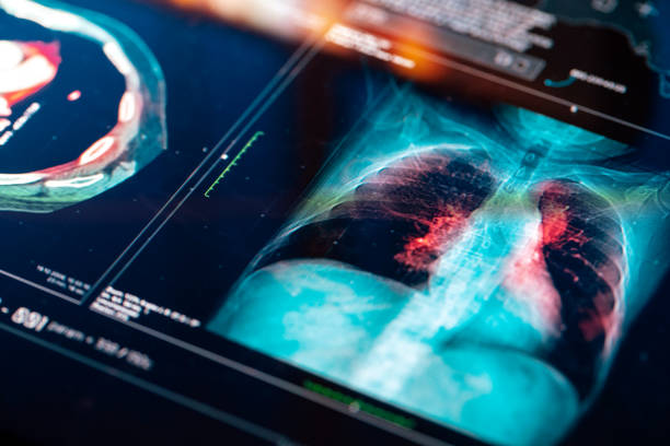 Abbott Laboratories and Its Strategic Role in the Lung Cancer Diagnostics Market: Emerging Innovations and Developments