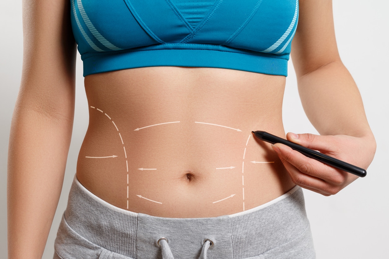 How Long Does a Tummy Tuck Surgery Usually Take?