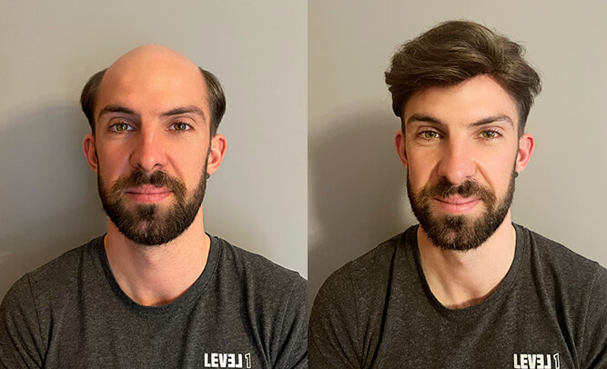 The Best Hair Systems for 2025: Top Picks for Natural Look and Comfort