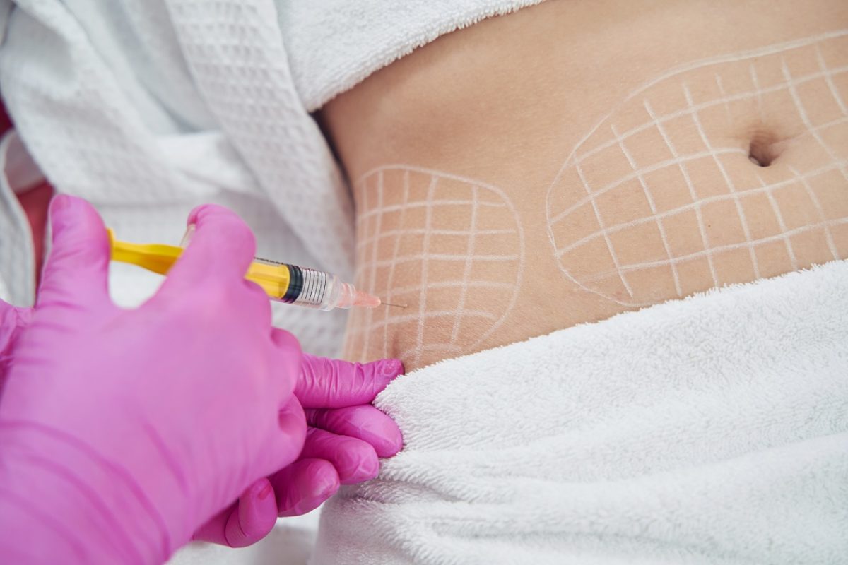 Dubai's Approach to Non-Surgical Fat Reduction