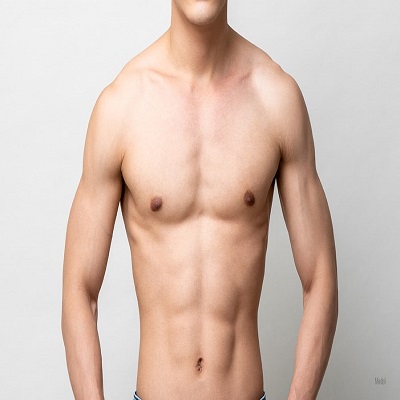 Can gynecomastia come back after surgery?