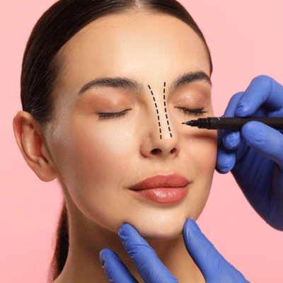 Rhinoplasty Recovery Timeline: What to Expect Week by Week