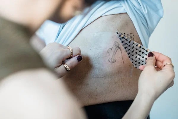 Tattoo Removal In Charlotte, NC – Safe, Effective, And Professional Services At Framed Beauty Co