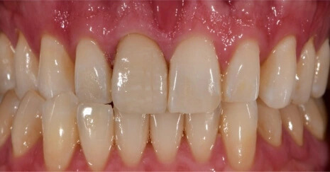 A Top-Rated Dentist in East Village: Your Smile Deserves the Best Care