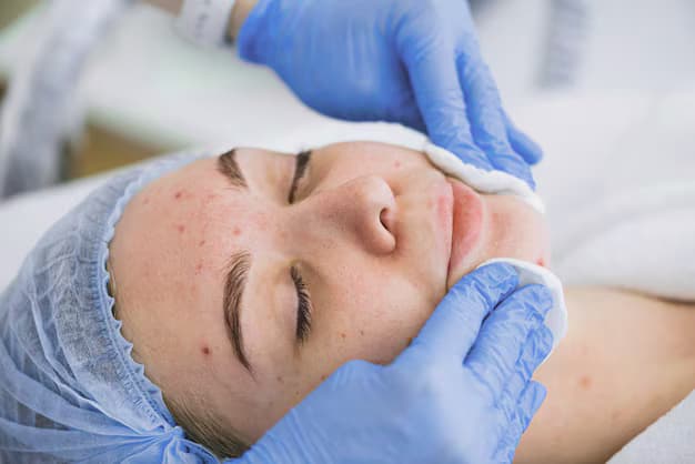 What Causes Melasma and How to Treat It in Birmingham