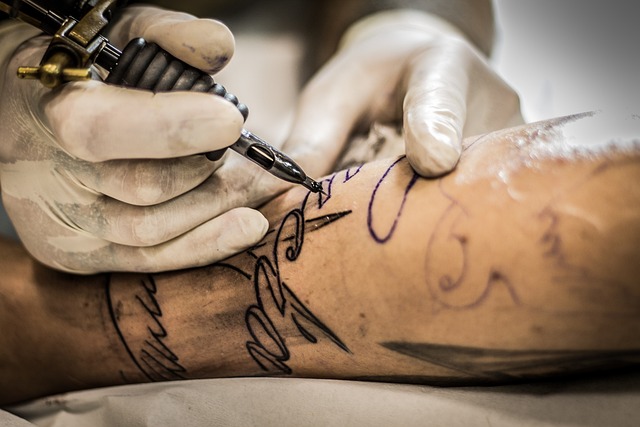 How to Decide If It's Time to Remove Your Old Tattoo