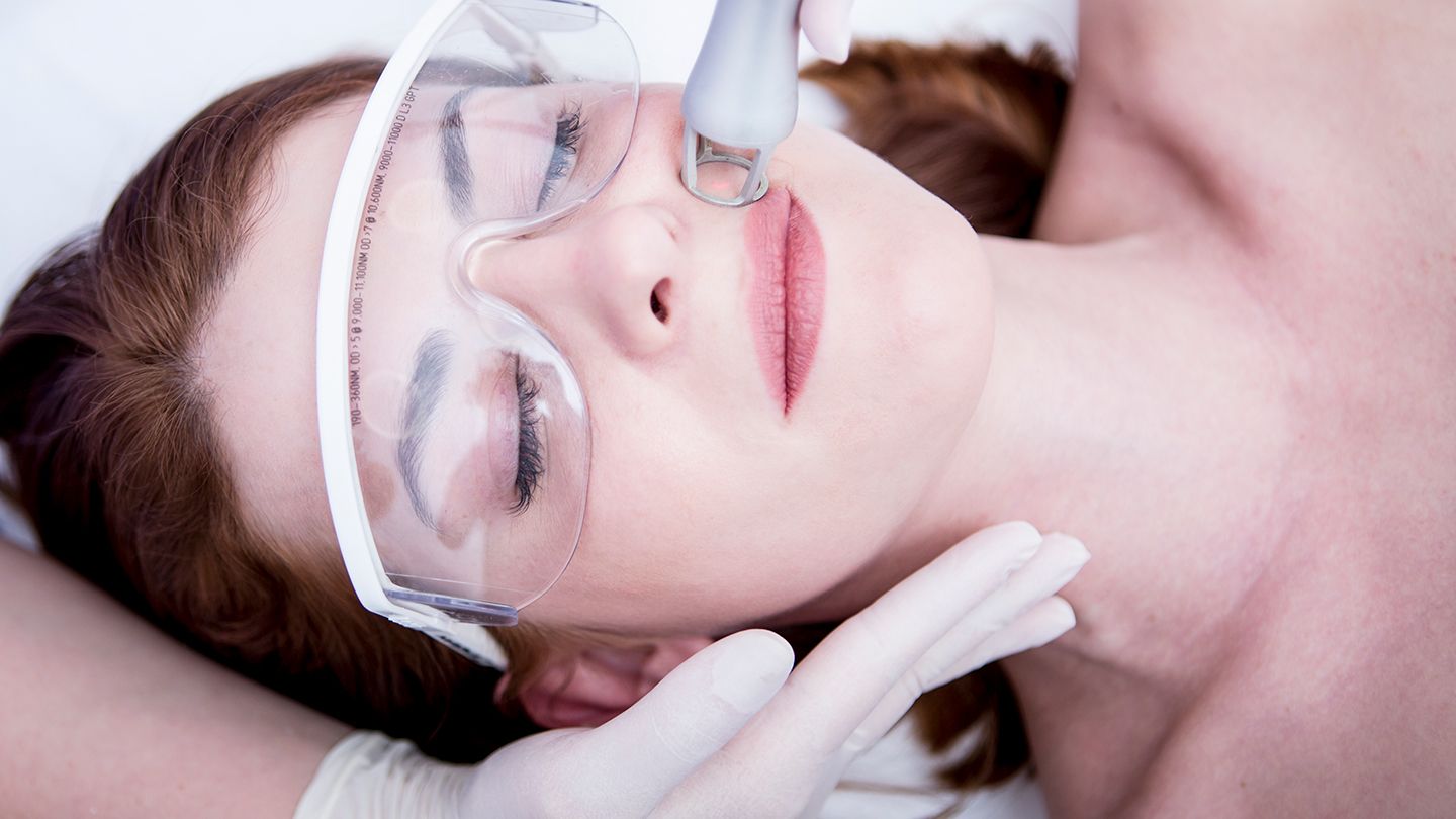 Is Laser Treatment the Best Anti-Aging Skincare Option?