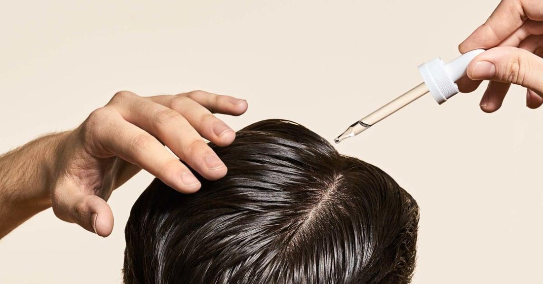 Struggling with Thinning Hair? Discover How Finasteride Can Help