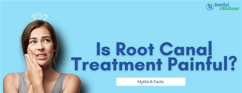 Is Root Canal Treatment Painful? Myths & Facts Explained