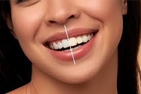 Laser Teeth Whitening in Islamabad: A Fast and Effective Solution to Brighten Your Smile