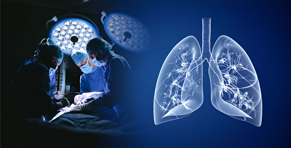 How Can Stem Cells Help Lung Disease?