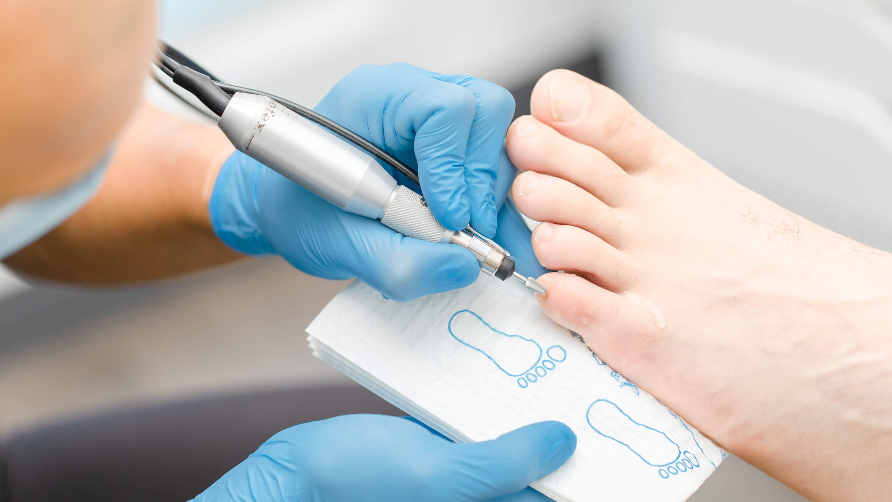 Top 10 Signs You Need to See a Chiropodist