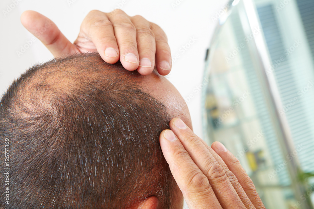 Is hair loss treatment painful?