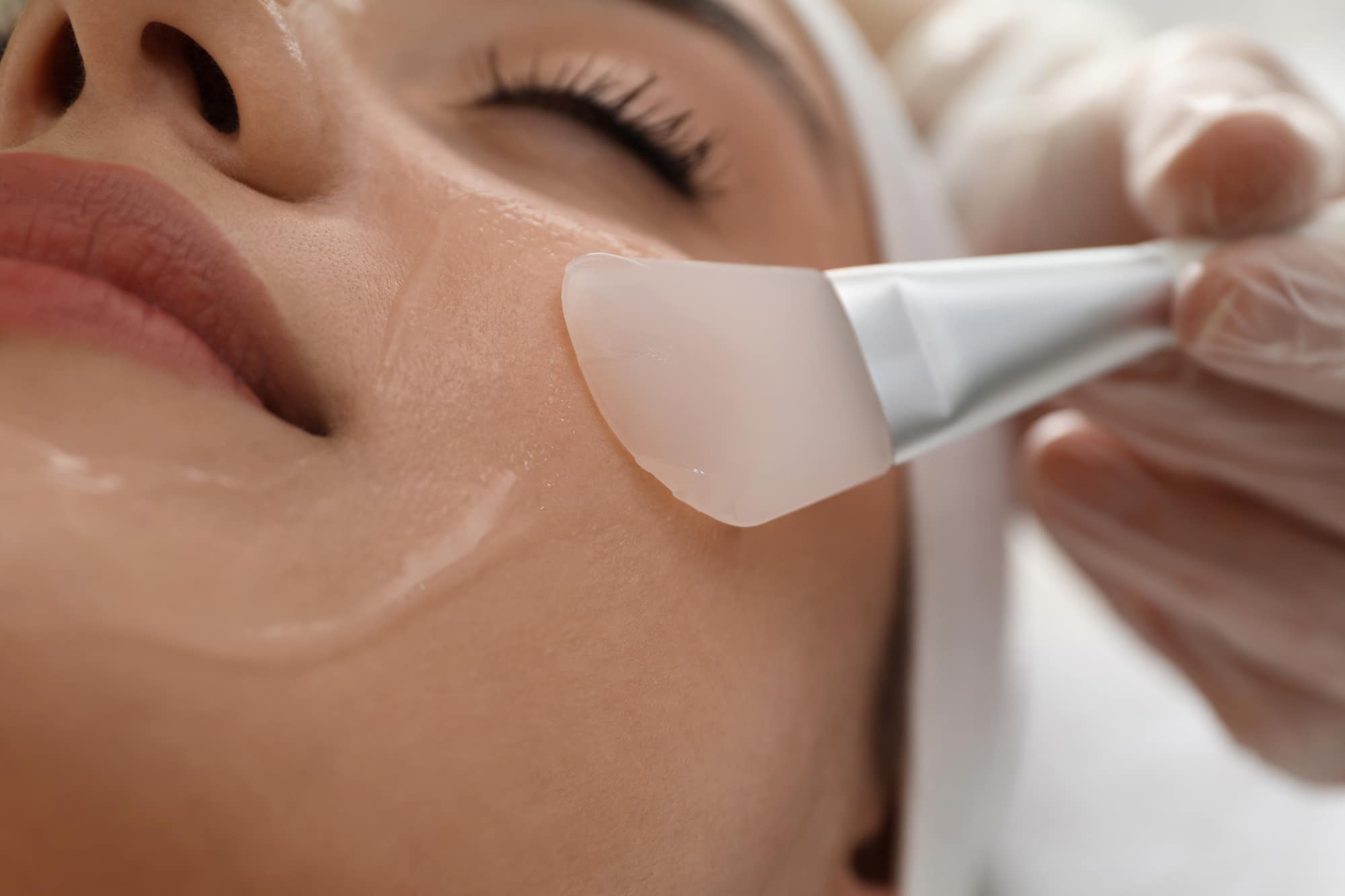 Cold Peel for Youthful-Looking Skin