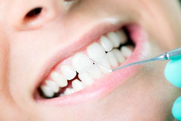 Can Teeth Cleaning in Dubai Help with Bad Breath Problems