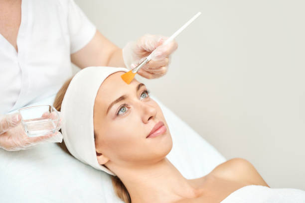 How Chemical Peels in Riyadh Improve Skin Tone